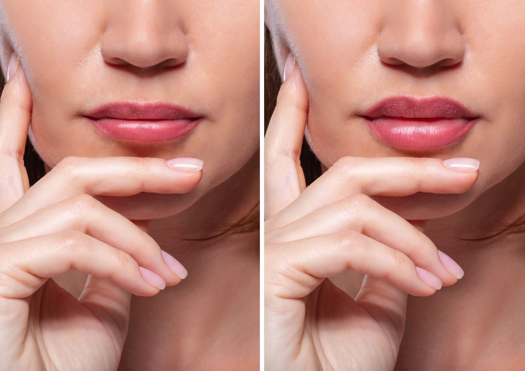 diferencia de labios en la feminización facial