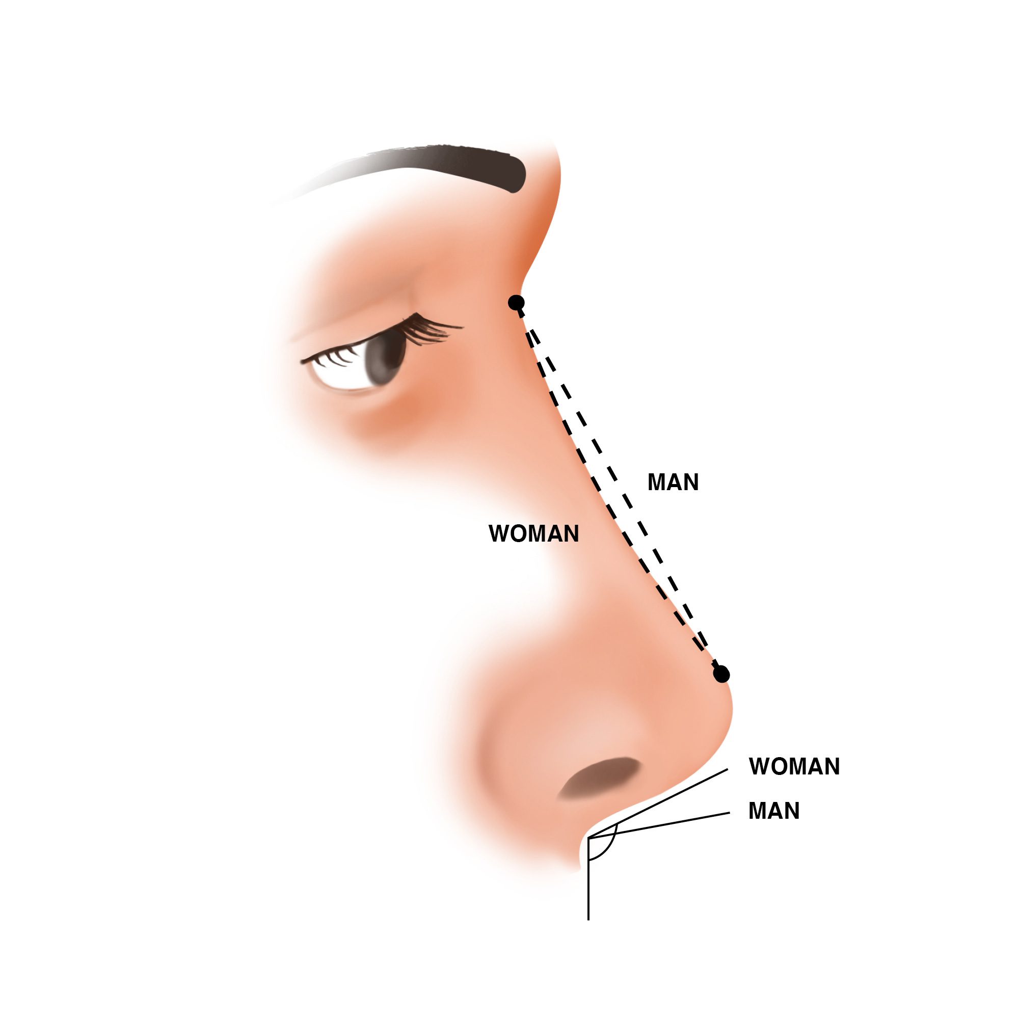 Ilustración sobre las diferencias entre la nariz masculina y la nariz femenina
